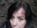 50-годишната Ралица, която падна в 3-метрова яма: Земята се отвори под краката ми, върху главата ми паднаха павета