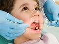 От днес до 30 ноември поставят безплатно силанти на детски зъби