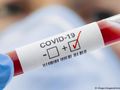 Петима нови заразени с Ковид-19, трима са в Белодробната болница