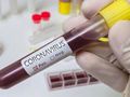 Жена с коронавирус от Борово вкара още двама души в списъка на заразените