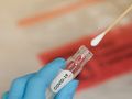 Лабораторията в болница „Канев“ също прави безплатни PCR тестове 