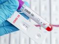 Русе на 10-то място по нови случаи на коронавирус