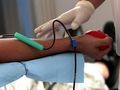 Търсят се кръводарители за работник с 90% изгаряния след трудова злополука