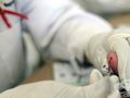 Три нови случая на СПИН в Русе