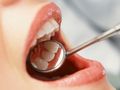 10 зъболекари преглеждат една седмица безплатно в Русе