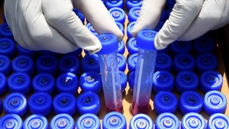 545 са новите случаи на коронавирус - 9,5 процента от тестовете