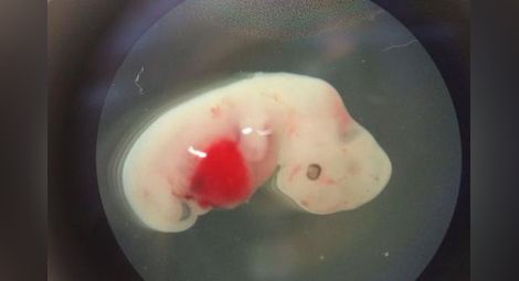 Този ембрион е инжектиран с човешки клетки на ранен етап от развитието му и е нараснал в продължение на четири седмици. Изследователите приложиха процедурата върху овце. Снимка: JUAN CARLOS IZPISUA BELMONTE