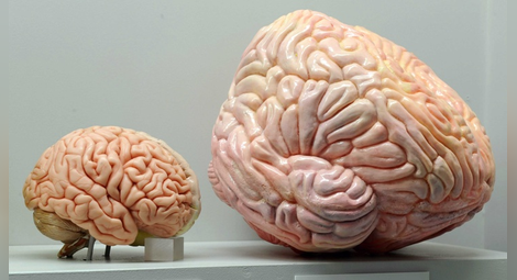 Учените откриха връзка между мозъка и нивото на доходи