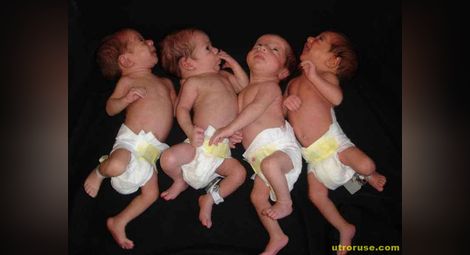 Британка роди четиризнаци - всичките момичета