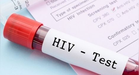 Тестове за СПИН в Световния ден за борба с болестта в Мол Русе