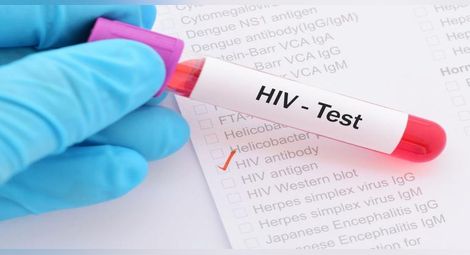 Шест нови случая наредиха Русе на пето място по ХИВ позитивни