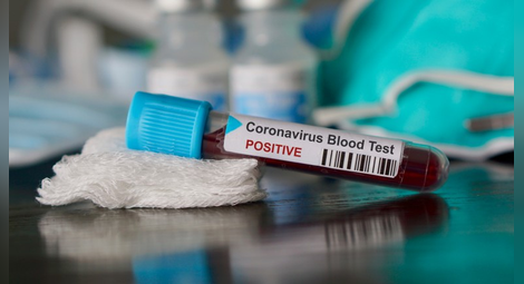 Трети случай на коронавирус в Испания
