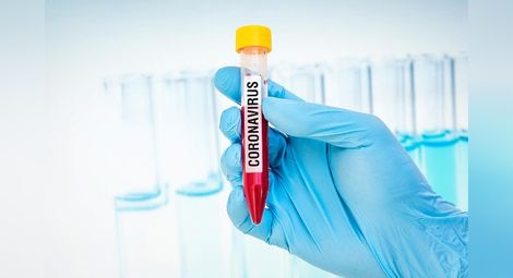 Куриерските фирми отказаха да доставят пробите за коронавирус в София