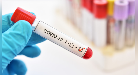 89 заразени с коронавирус, 63-ма излекувани