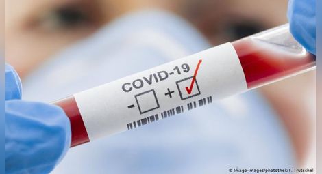 Осем нови случая на коронавирус в Русе, двама излекувани