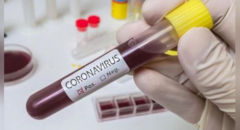 Болните от коронавирус в Русе надхвърлиха 100