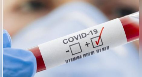 Четирима нови заразени с Ковид-19 след два дни затишие