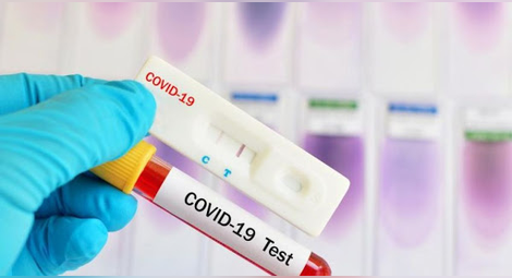 98 нови случаи на COVID-19 в Русе