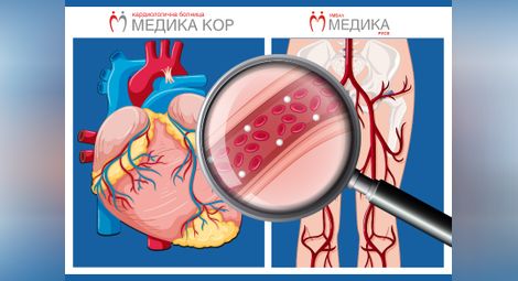 "Медика" определи две дати през  април за безплатна профилактика на сърцето
