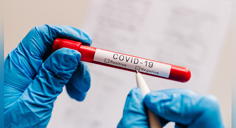 Без смъртни случаи от COVID-19 за последното денонощие