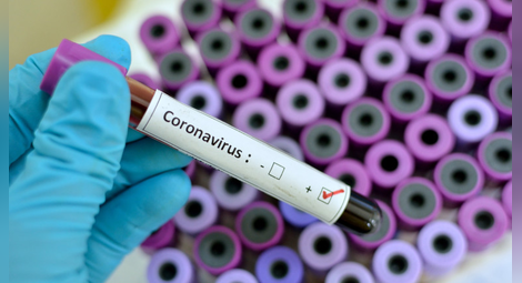 У нас през последното денонощие бяха регистрирани 1424 нови случая на заразяване с коронавирус