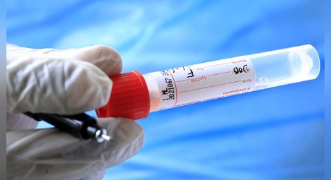 48 заразени с Ковид-19 в Русе и областта за денонощие, 102 излекувани, четирима починали