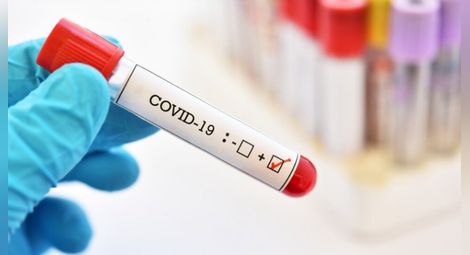7 пъти повече заразени с Ковид-19 през юли