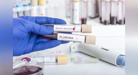 Първи случай в Русе на флурона - коинфекция с грип и коронавирус