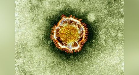 Откриха смъртоносен вирус в Испания