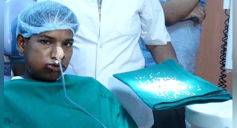 Хирурзи извадиха от устата на индиец 232 зъба
