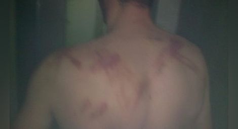 Полицаи в Любимец чупили глави и крайници на алжирци