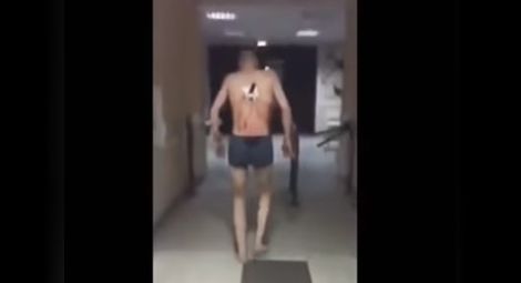 Руснак излиза от болницата да пуши с нож в гърба (Видео)