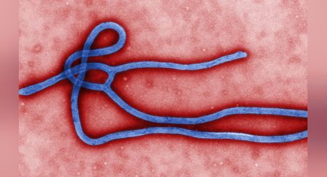 Починалият в Македония британец няма ебола, а цироза