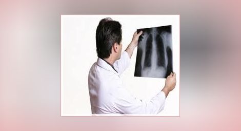 Цяла седмица безплатни прегледи на белите дробове в Русе