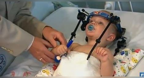 В Австралия: Лекари спасиха бебе със счупен врат