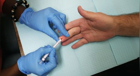 НЗОК ще заплаща най-съвременното лечение на пациенти с хепатит С