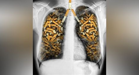 Край на ароматите в цигарите, 65% от опаковката със здравни изображения