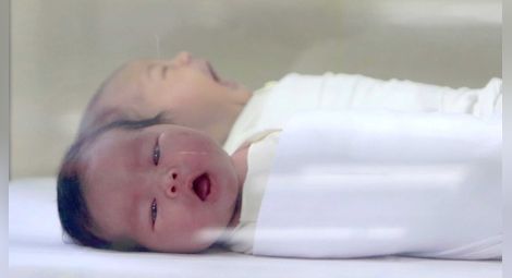 Учени предлагат акупунктура срещу колики при бебета