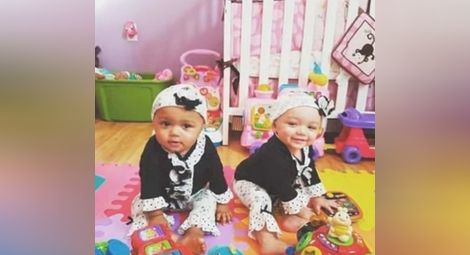 Жена роди близначки с различен цвят на кожата