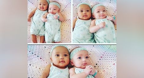 Жена роди близначки с различен цвят на кожата