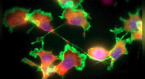 Учени откриха молекула, задействаща клетки убийци на раковия тумор