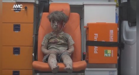Момчето, станало символ на войната в Сирия, се появи отново в публичното пространство